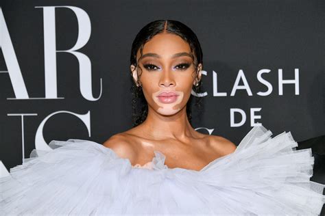 Winnie Harlow Net Worth 2024: From Runway to Riches